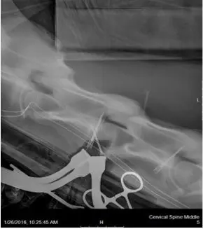 A black and white photo of scissors in smoke.