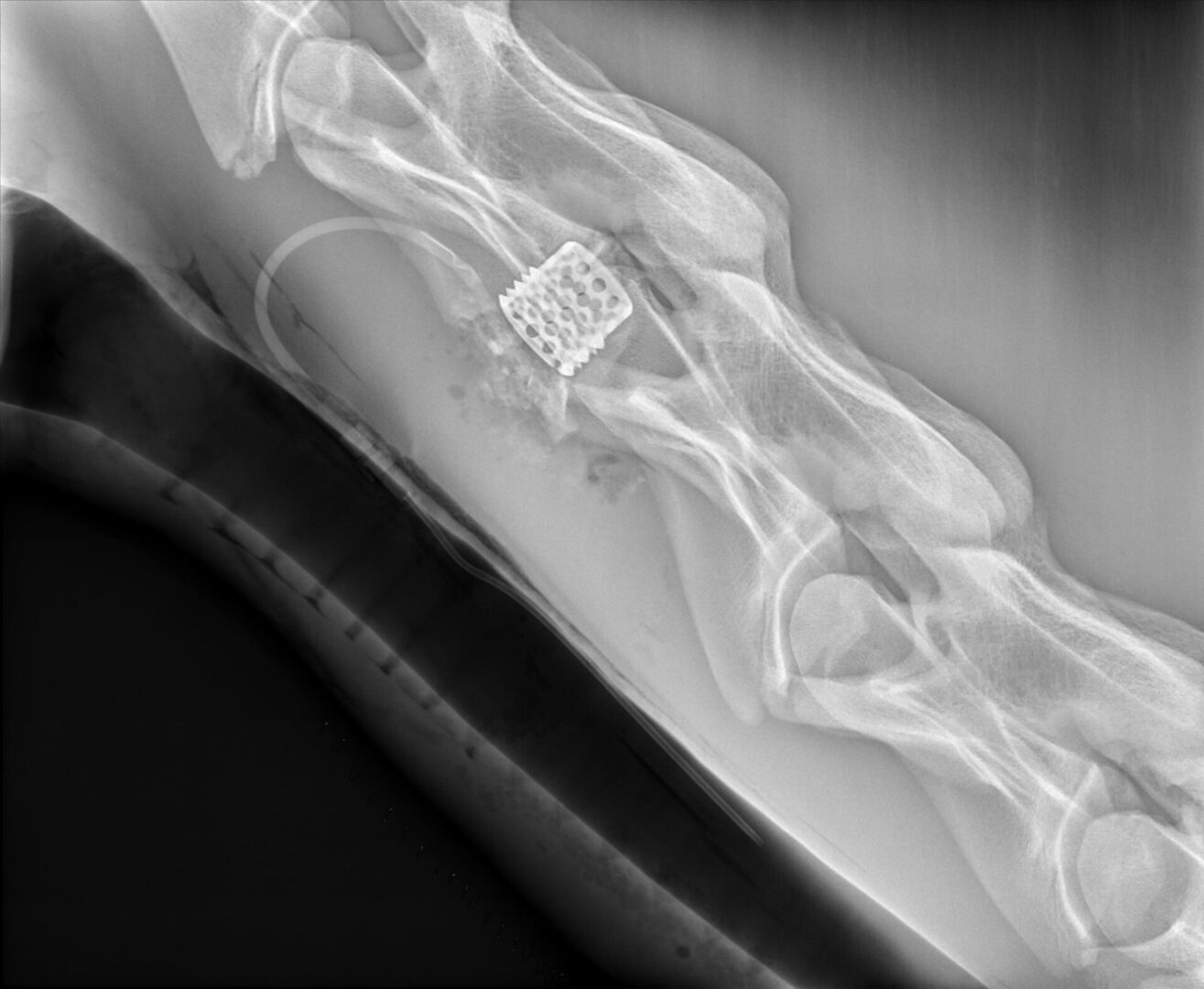 A black and white photo of an x-ray showing the bottom part of a wrist.